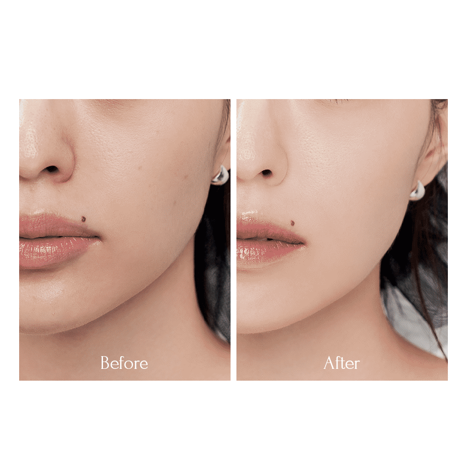 Confronto del viso prima e dopo l’applicazione del fondotinta MUZIGAE MANSION Sleek Matt Cushion